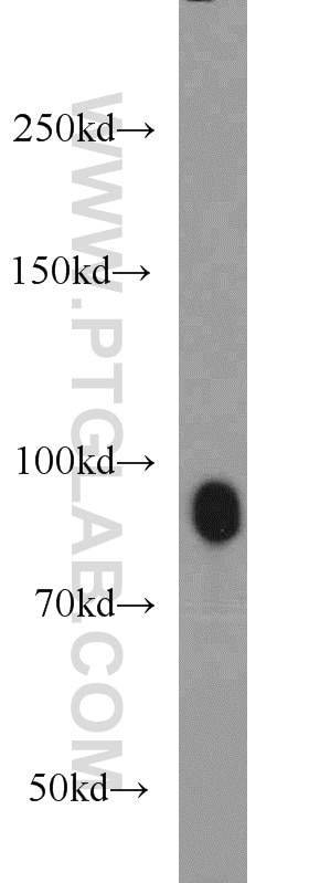 Western Blot (WB) analysis of HeLa cells using UHRF1 Polyclonal antibody (21402-1-AP)