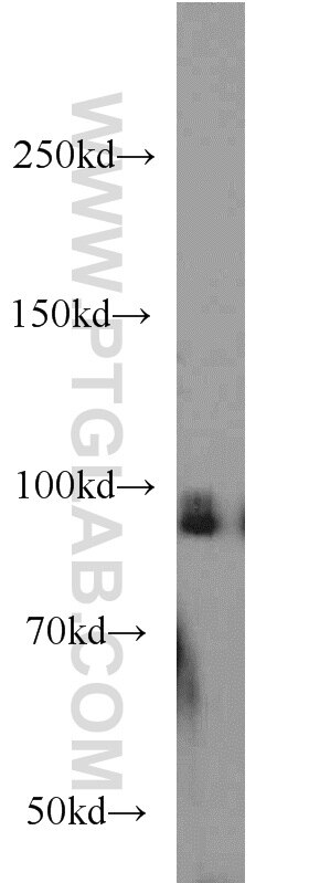 Western Blot (WB) analysis of MCF-7 cells using UHRF1 Polyclonal antibody (21402-1-AP)