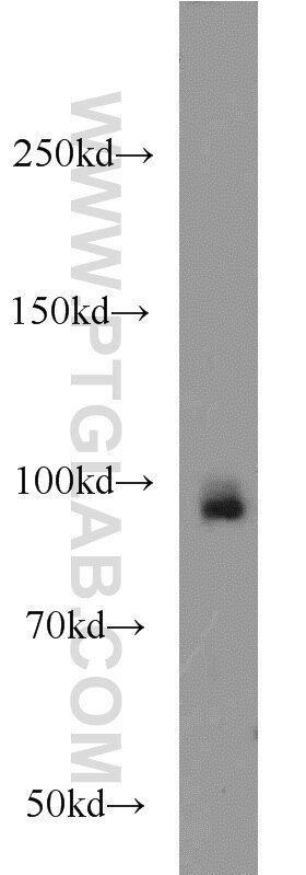 Western Blot (WB) analysis of MCF-7 cells using UHRF1 Polyclonal antibody (21402-1-AP)