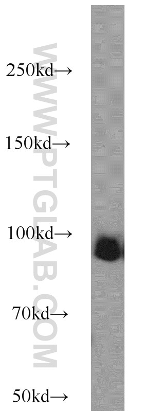 Western Blot (WB) analysis of HeLa cells using UHRF1 Polyclonal antibody (21402-1-AP)