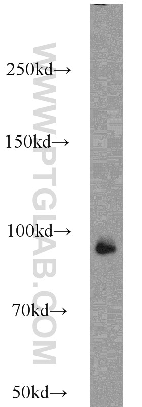Western Blot (WB) analysis of HeLa cells using UHRF1 Polyclonal antibody (21402-1-AP)