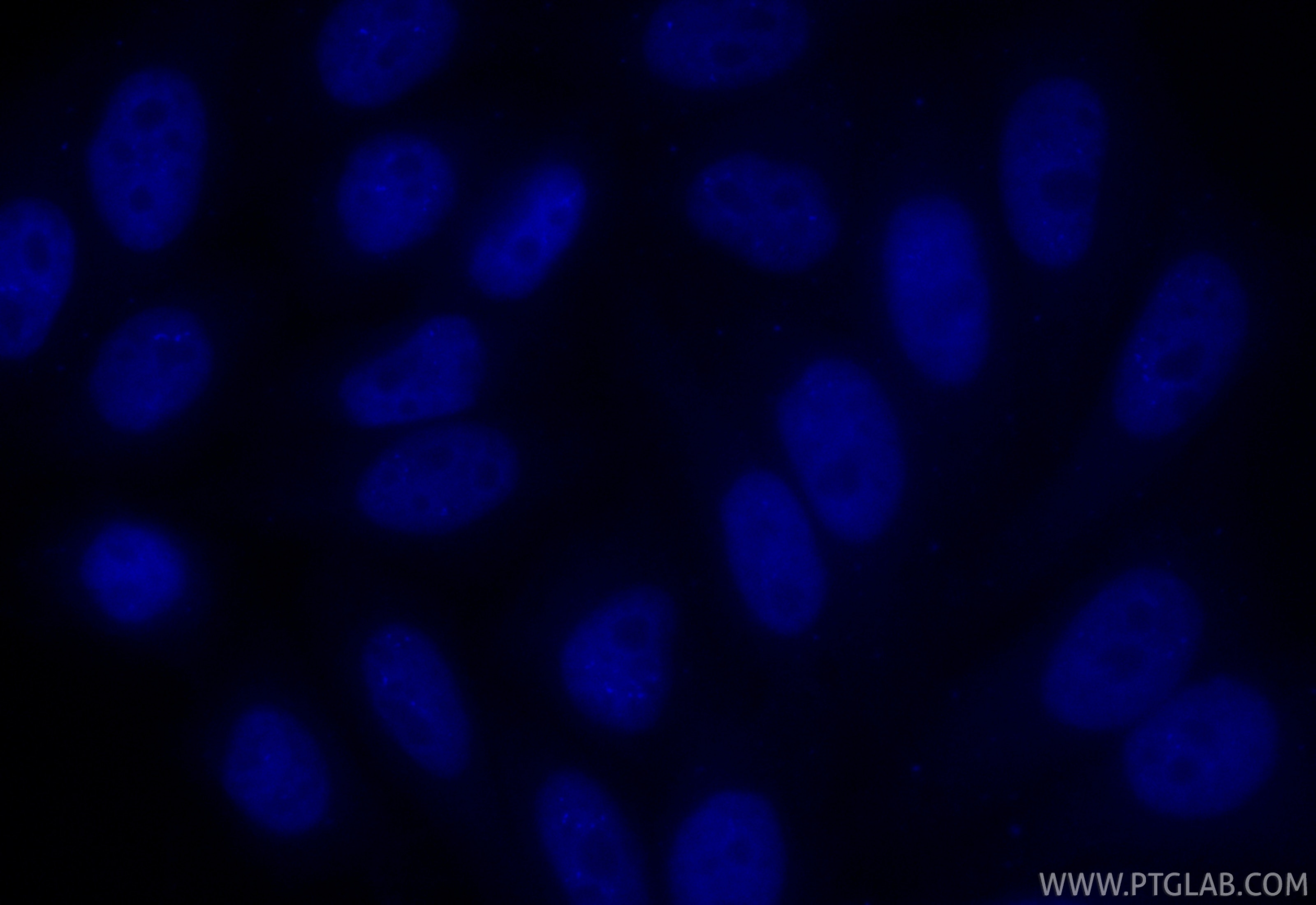 Immunofluorescence (IF) / fluorescent staining of HepG2 cells using CoraLite® Plus 405-conjugated UHRF1 Recombinant mo (CL405-84489-4)