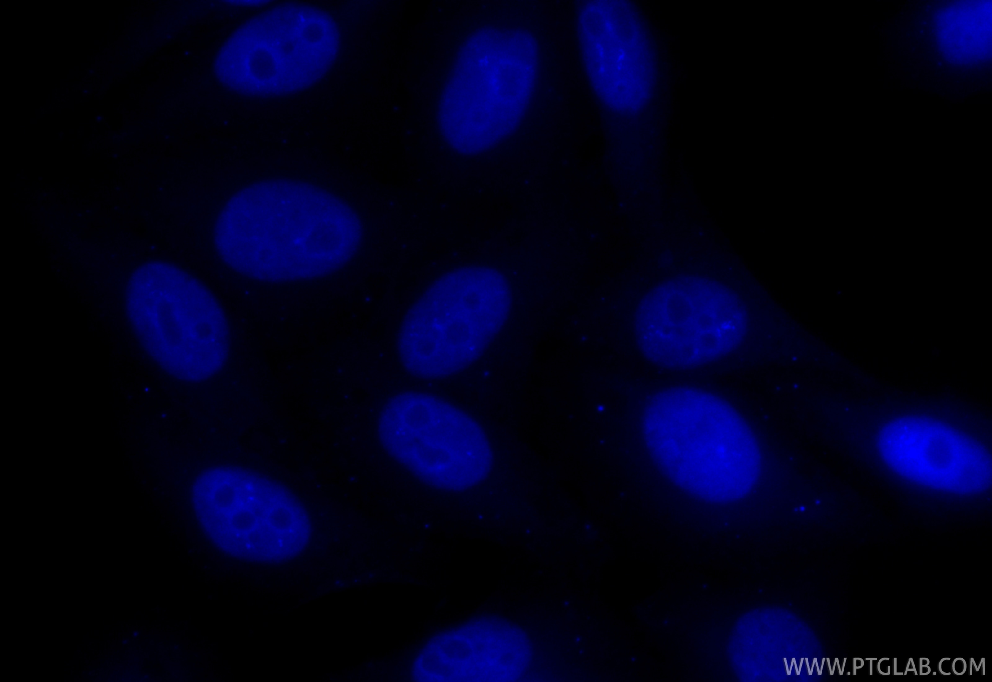 Immunofluorescence (IF) / fluorescent staining of HepG2 cells using CoraLite® Plus 405-conjugated UHRF1 Recombinant mo (CL405-84489-5)