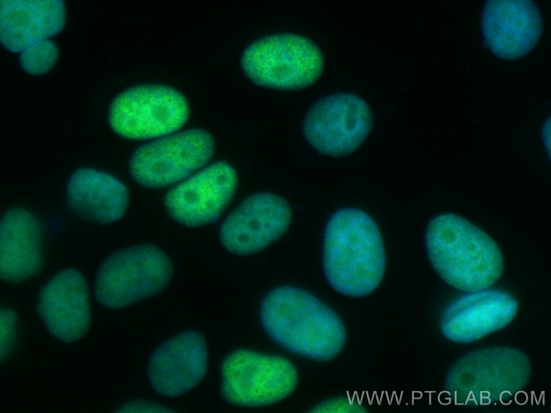 Immunofluorescence (IF) / fluorescent staining of HepG2 cells using CoraLite® Plus 488-conjugated UHRF1 Recombinant an (CL488-84489-4)