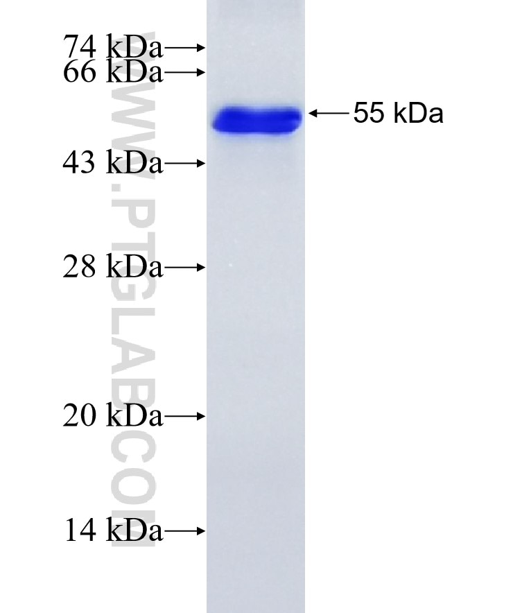UHRF1 fusion protein Ag17498 SDS-PAGE