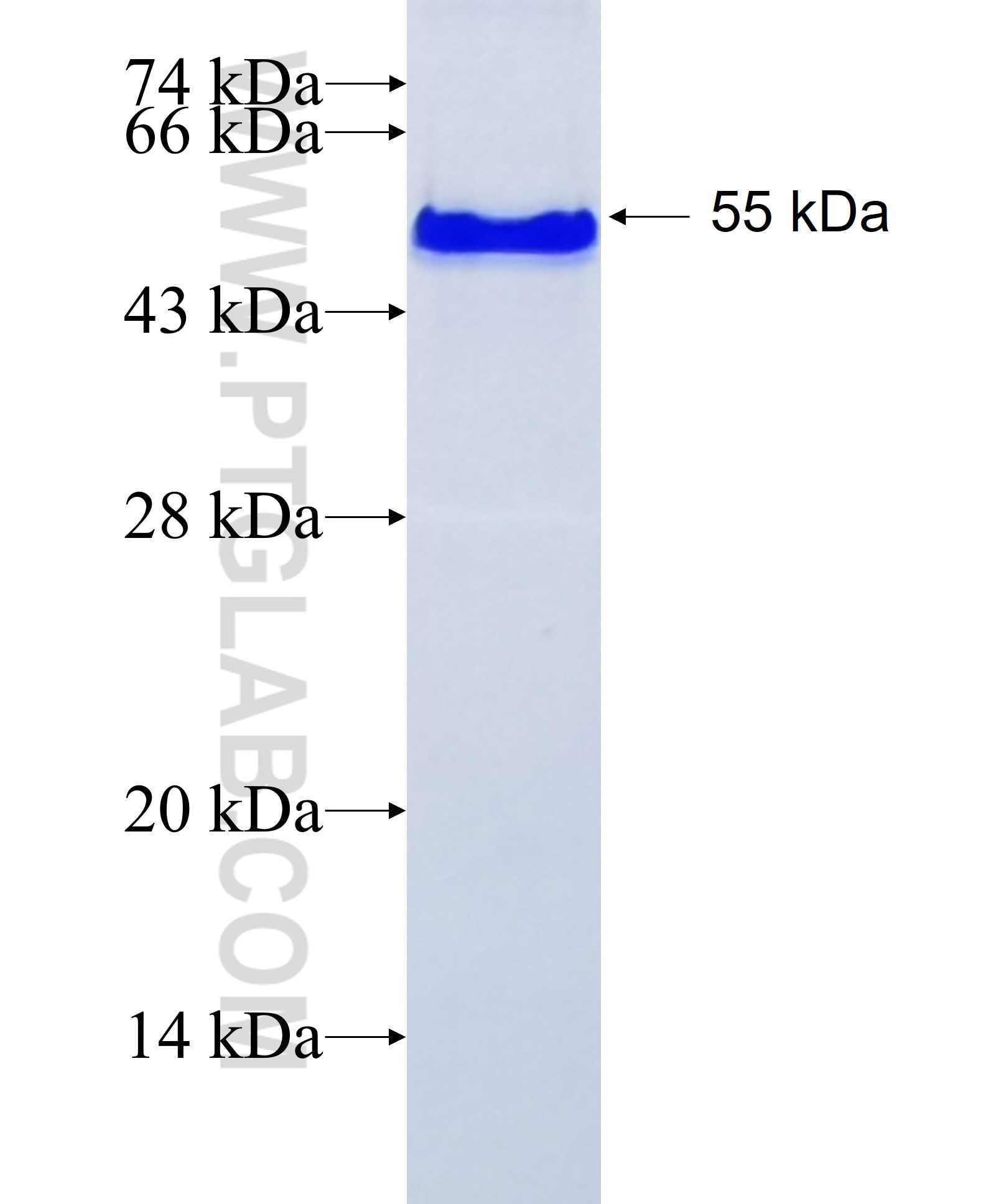 UHRF1 fusion protein Ag17498 SDS-PAGE