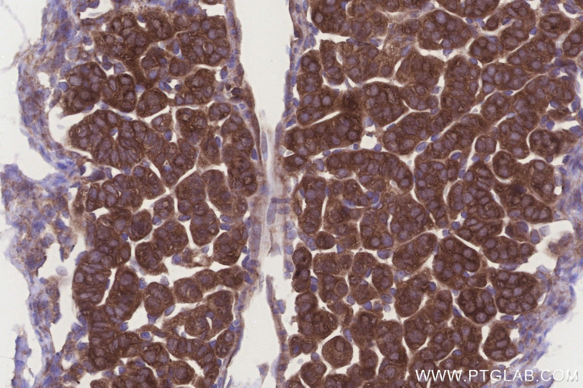 IHC staining of mouse adrenal gland using 24345-1-AP Immunohistochemistry (IHC) staining of mouse adrenal gland tissue using UHRF1BP1 Polyclonal antibody (24345-1-AP)