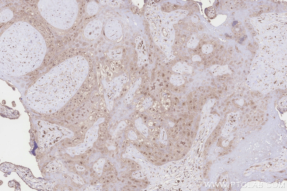 IHC staining of human placenta using 24345-1-AP Immunohistochemistry (IHC) staining of human placenta tissue using UHRF1BP1 Polyclonal antibody (24345-1-AP)
