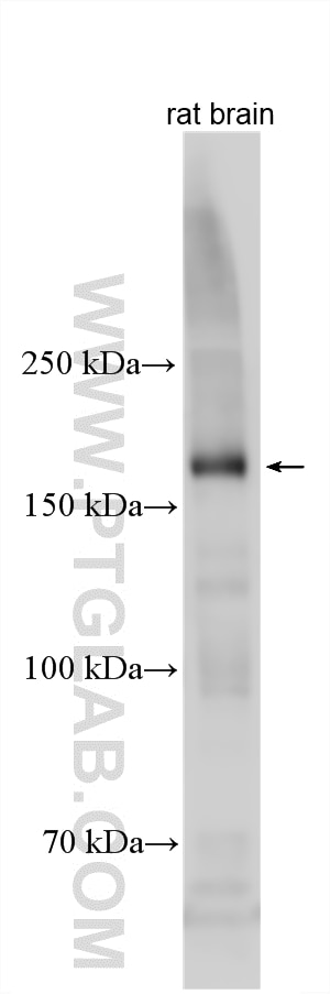 Various lysates were subjected to SDS PAGE followed by western blot with 25121-1-AP (UHRF1BP1L antibody) at dilution of 1:5000 incubated at room temperature for 1.5 hours. Western Blot (WB) analysis of various lysates using UHRF1BP1L Polyclonal antibody (25121-1-AP)