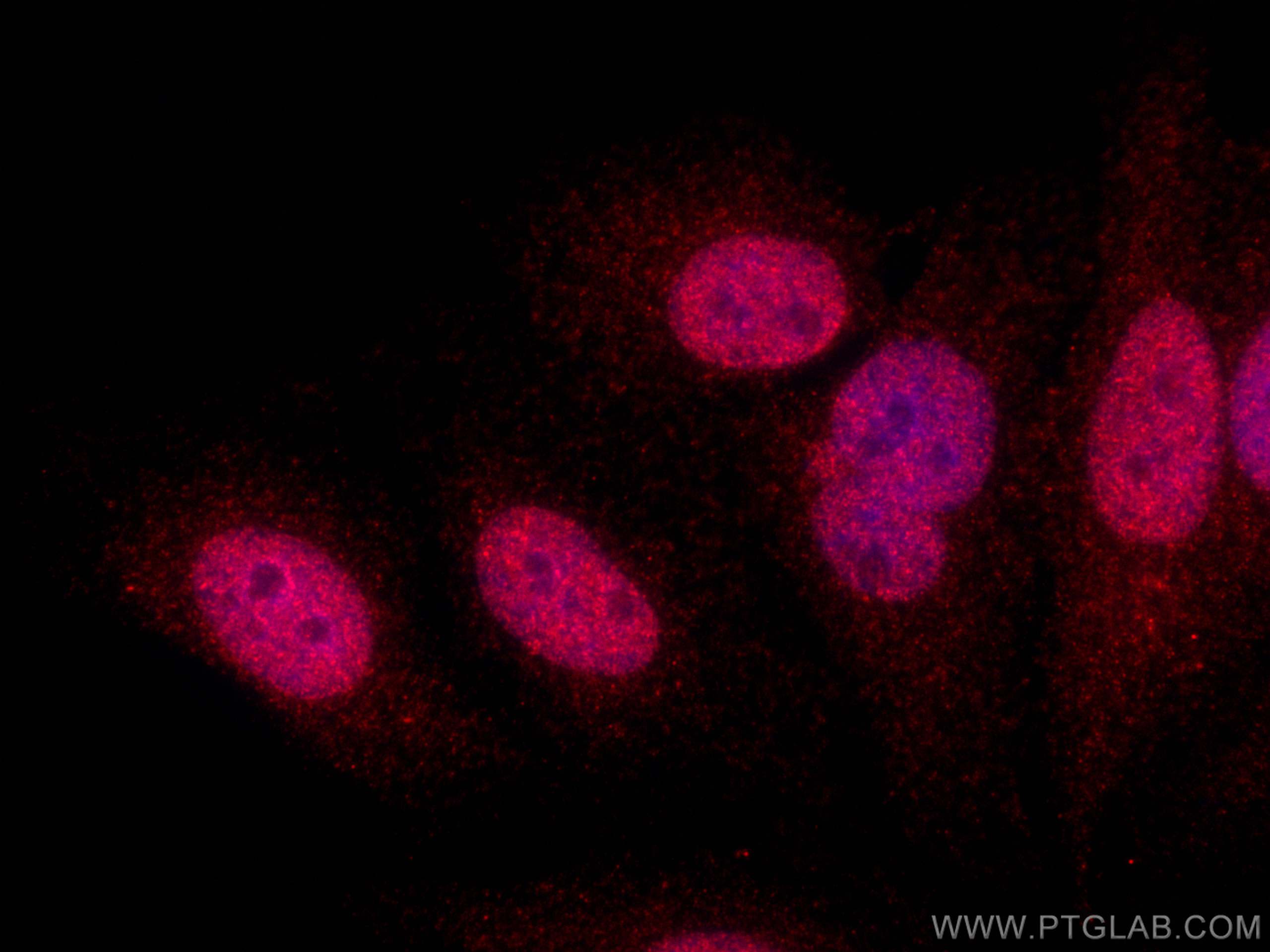 Immunofluorescence (IF) / fluorescent staining of HepG2 cells using UHRF2 Polyclonal antibody (25710-1-AP)