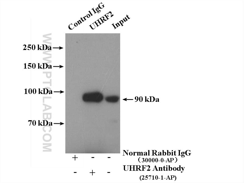 Immunoprecipitation (IP) experiment of Jurkat cells using UHRF2 Polyclonal antibody (25710-1-AP)