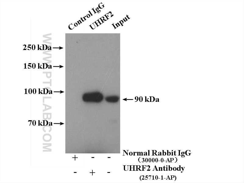 Immunoprecipitation (IP) experiment of Jurkat cells using UHRF2 Polyclonal antibody (25710-1-AP)