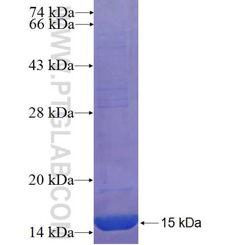 UHRF2 fusion protein Ag22518 SDS-PAGE