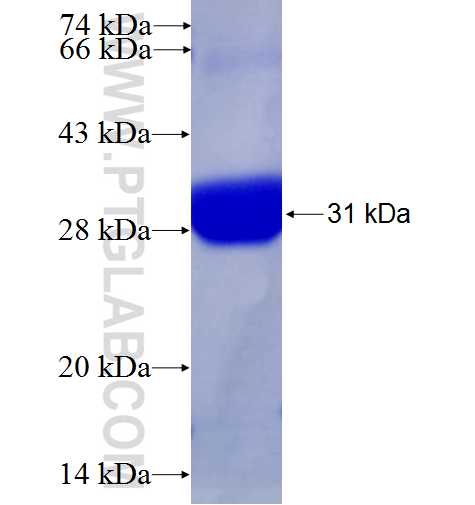 UHRF2 fusion protein Ag22519 SDS-PAGE