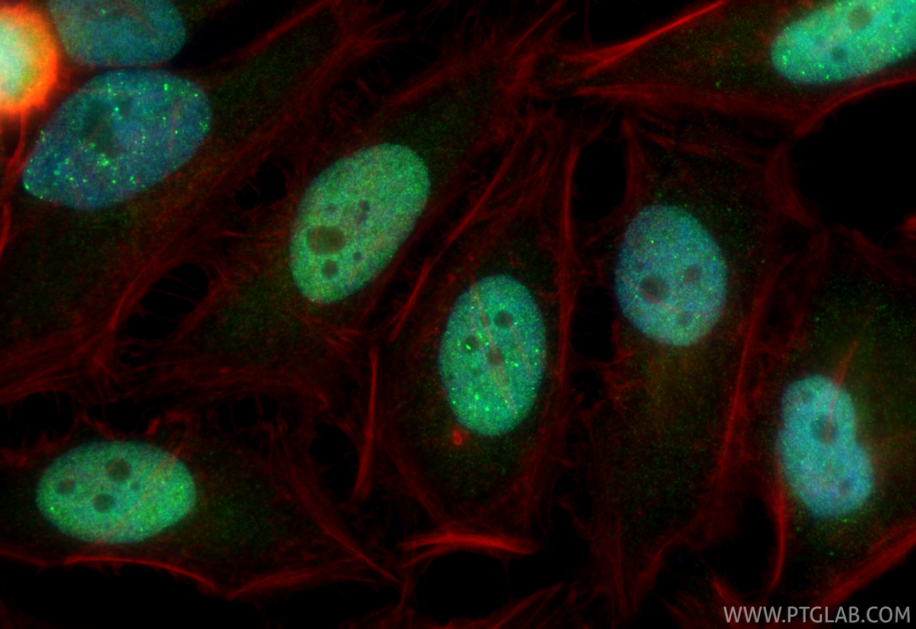 Immunofluorescence (IF) / fluorescent staining of HeLa cells using UIMC1 Polyclonal antibody (13642-1-AP)