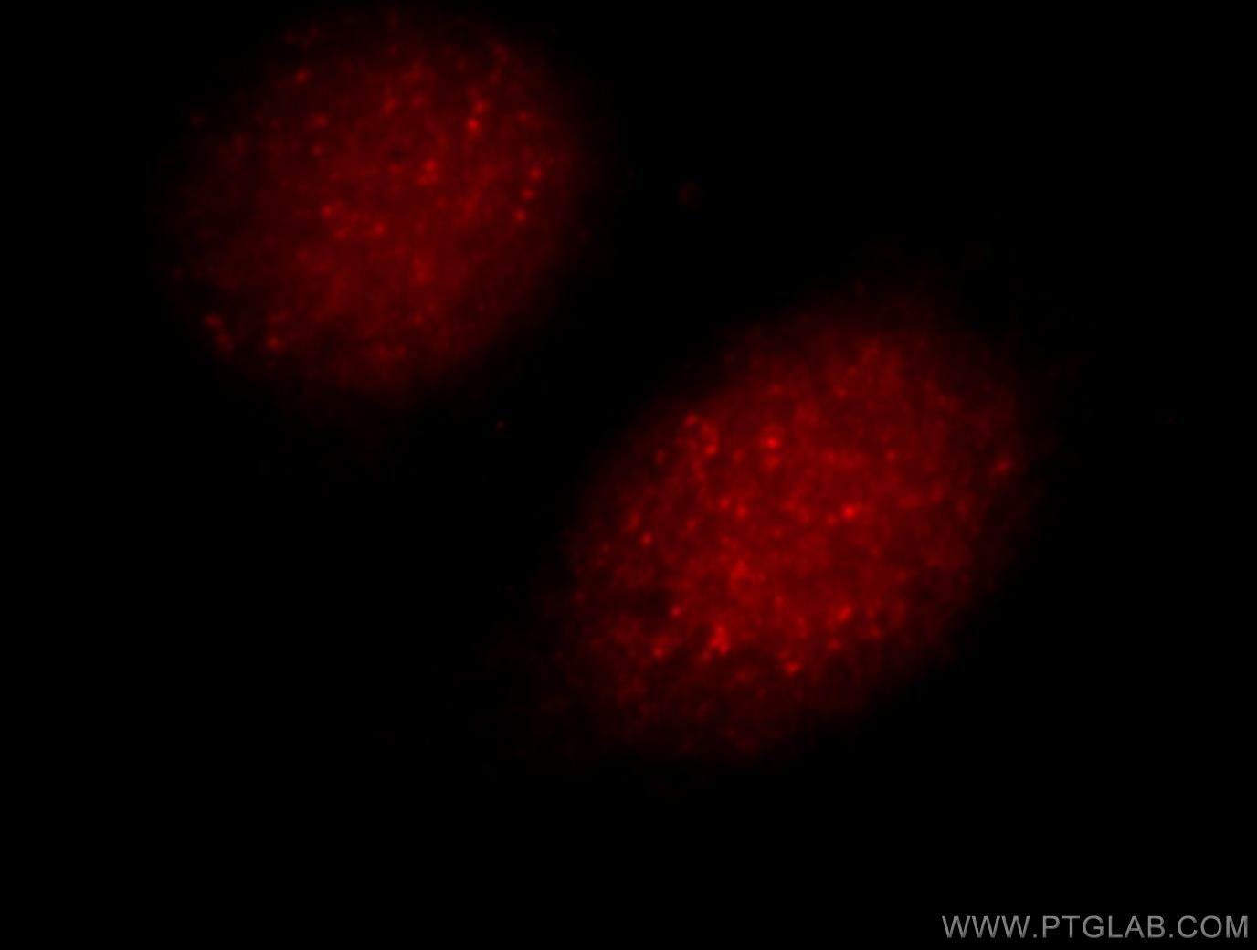 Immunofluorescence (IF) / fluorescent staining of HeLa cells using UIMC1 Polyclonal antibody (13642-1-AP)