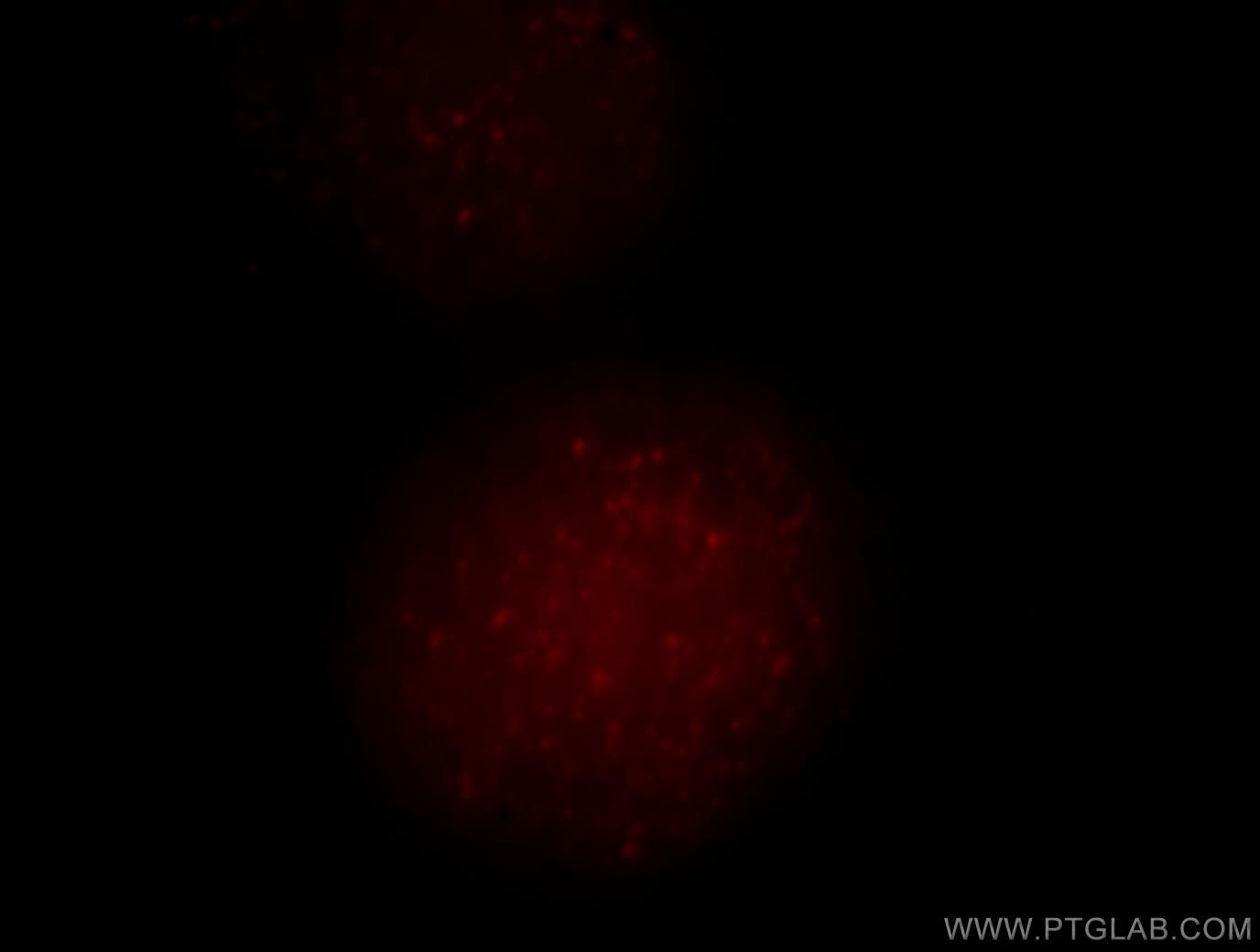 Immunofluorescence (IF) / fluorescent staining of HeLa cells using UIMC1 Polyclonal antibody (13642-1-AP)