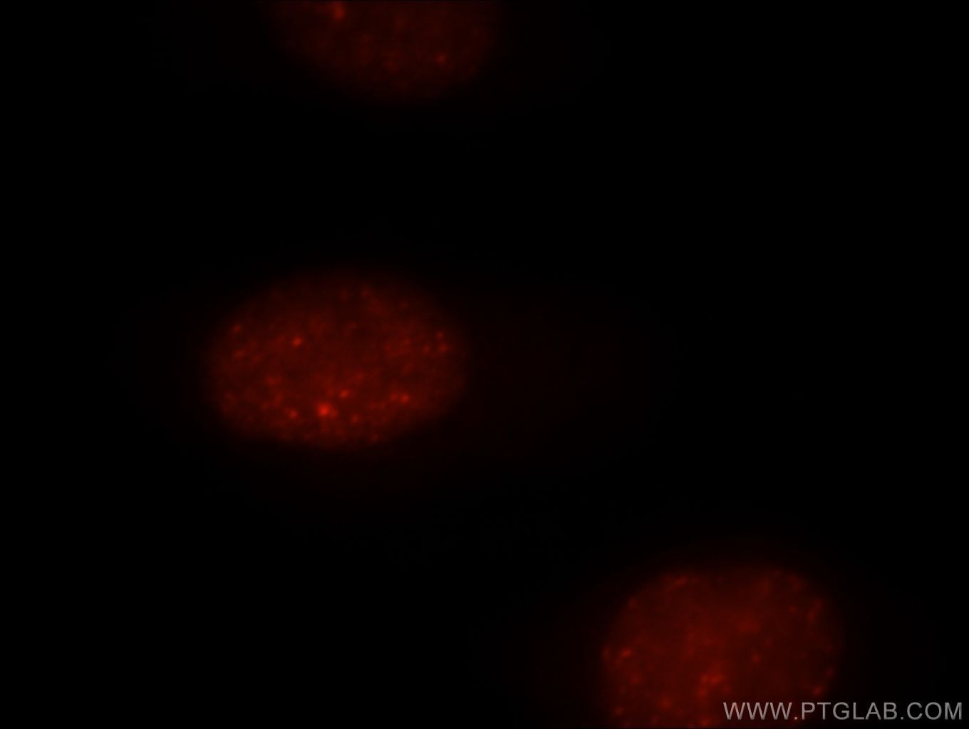 Immunofluorescence (IF) / fluorescent staining of MCF-7 cells using UIMC1 Polyclonal antibody (13642-1-AP)
