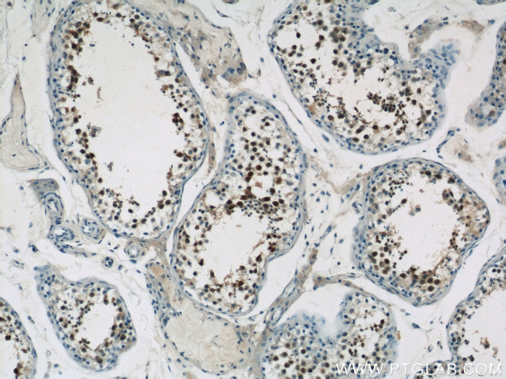 Immunohistochemistry (IHC) staining of human testis tissue using UIMC1 Polyclonal antibody (13642-1-AP)