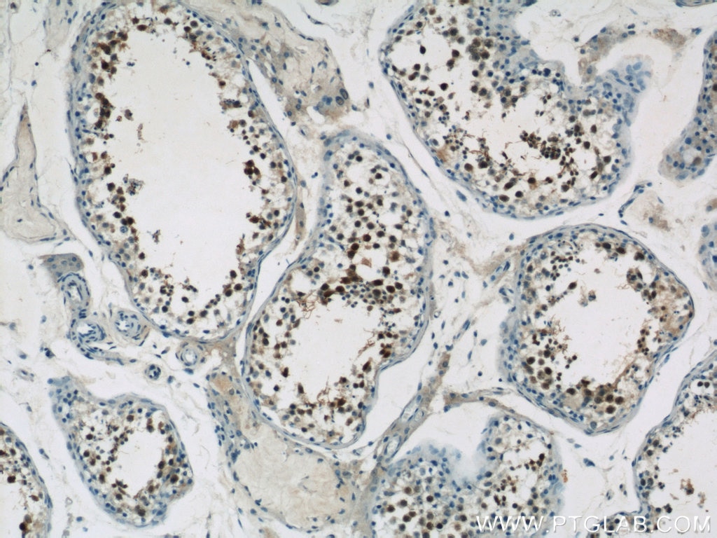 IHC staining of human testis using 13642-1-AP