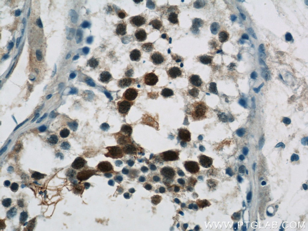 Immunohistochemistry (IHC) staining of human testis tissue using UIMC1 Polyclonal antibody (13642-1-AP)