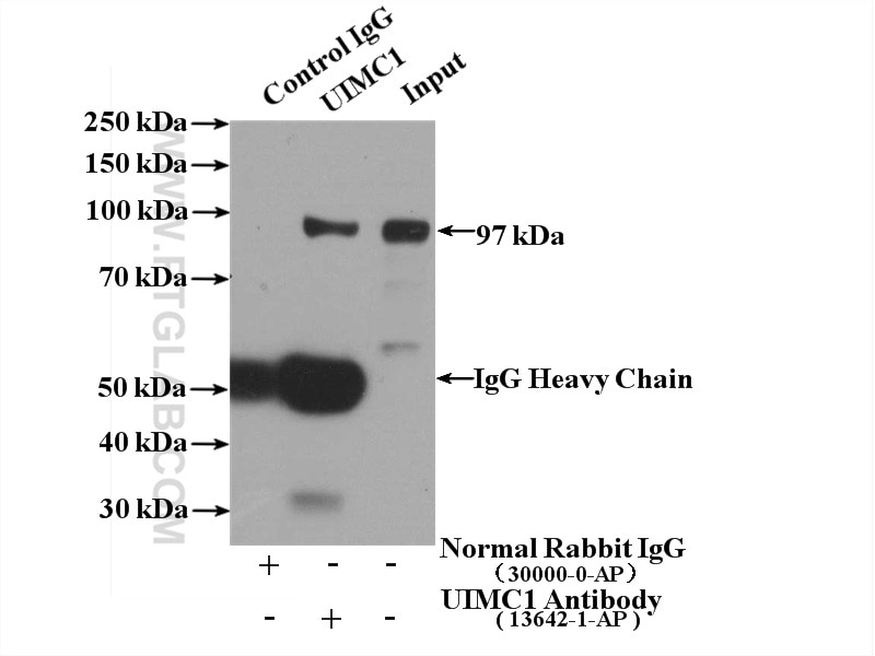 Immunoprecipitation (IP) experiment of COLO 320 cells using UIMC1 Polyclonal antibody (13642-1-AP)