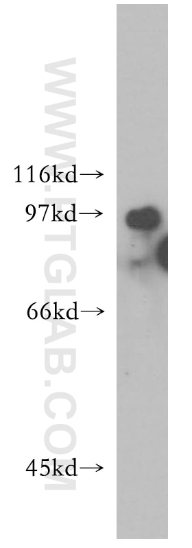 Western Blot (WB) analysis of Raji cells using UIMC1 Polyclonal antibody (13642-1-AP)