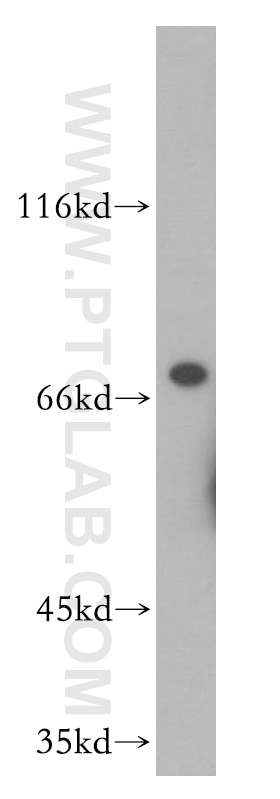 Western Blot (WB) analysis of mouse colon tissue using UIMC1 Polyclonal antibody (13642-1-AP)