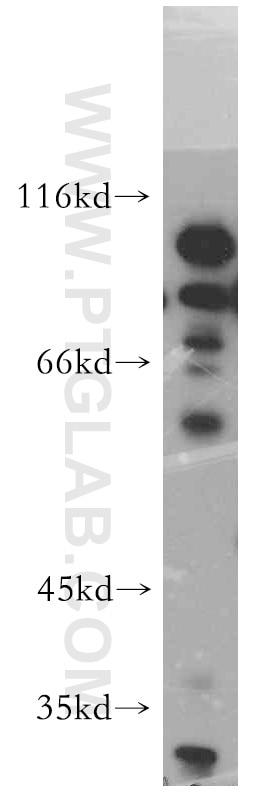 Western Blot (WB) analysis of HeLa cells using UIMC1 Polyclonal antibody (13642-1-AP)