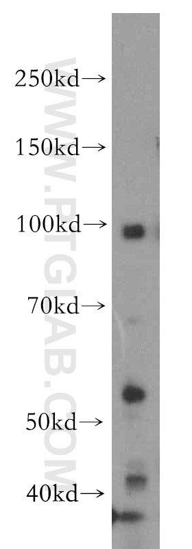 Western Blot (WB) analysis of COLO 320 cells using UIMC1 Polyclonal antibody (13642-1-AP)