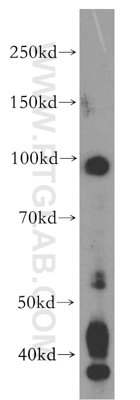 Western Blot (WB) analysis of COLO 320 cells using UIMC1 Polyclonal antibody (13642-1-AP)