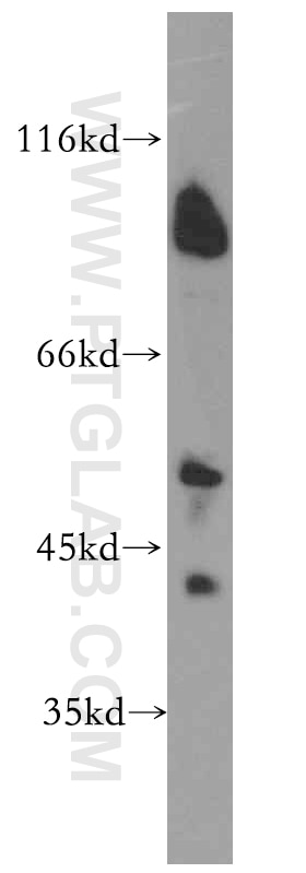 Western Blot (WB) analysis of HeLa cells using UIMC1 Polyclonal antibody (13642-1-AP)