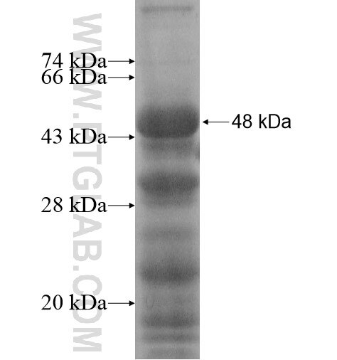 UIMC1 fusion protein Ag14475 SDS-PAGE