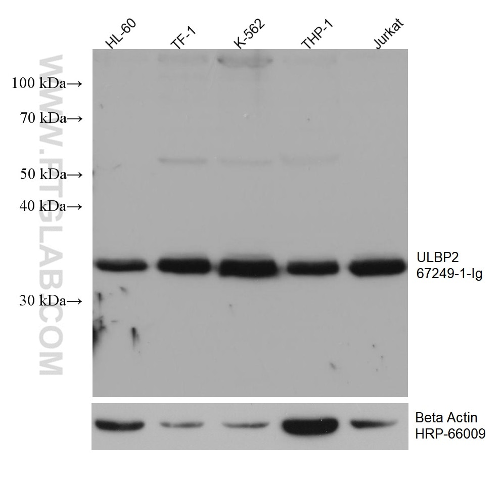 Western Blot (WB) analysis of various lysates using ULBP2 Monoclonal antibody (67249-1-Ig)