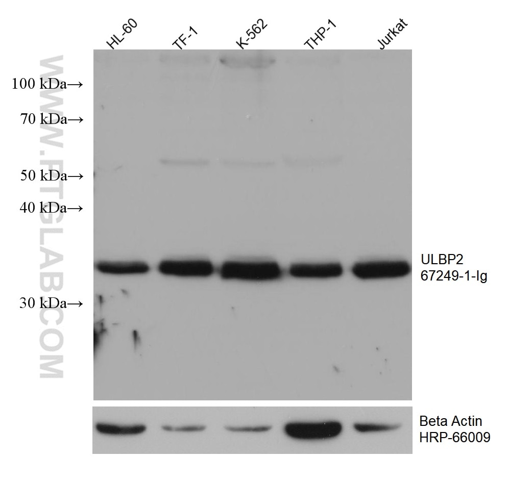 WB analysis using 67249-1-Ig