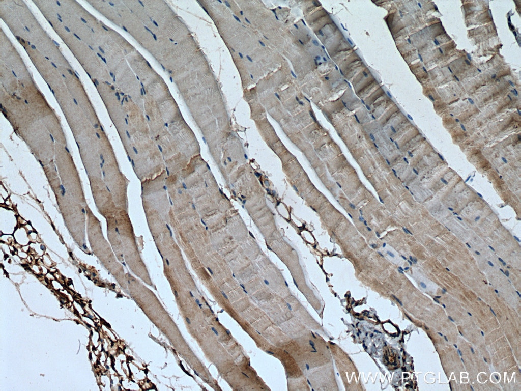 Immunohistochemistry (IHC) staining of mouse skeletal muscle tissue using ULK1 Polyclonal antibody (20986-1-AP)