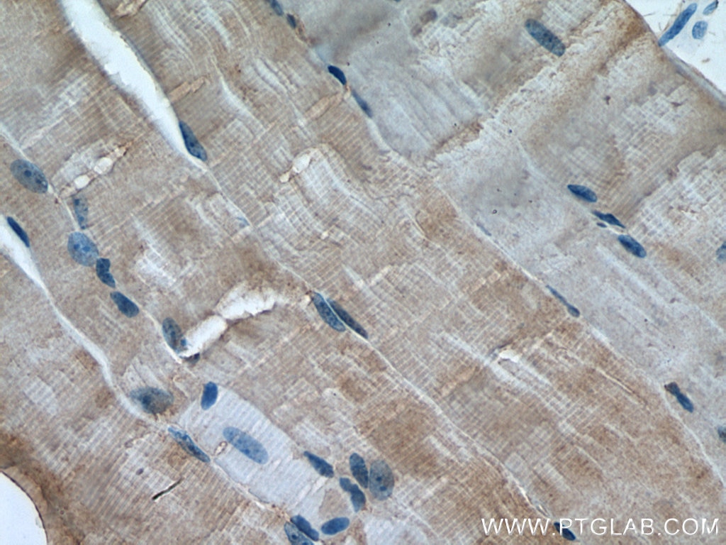 Immunohistochemistry (IHC) staining of mouse skeletal muscle tissue using ULK1 Polyclonal antibody (20986-1-AP)