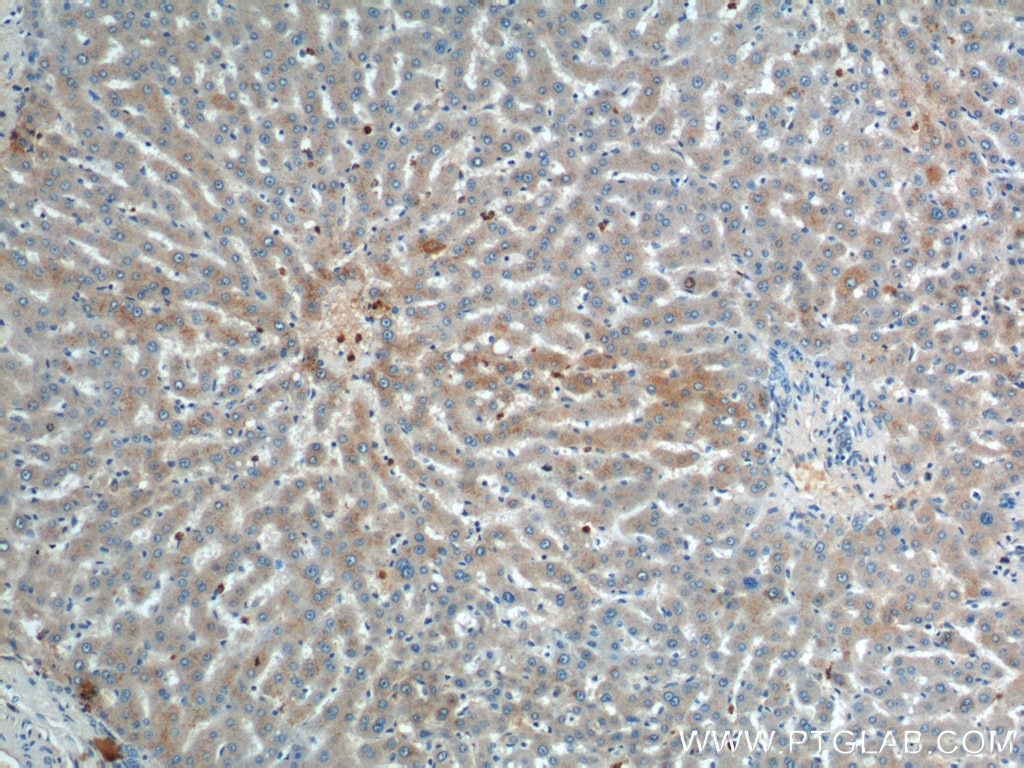 Immunohistochemistry (IHC) staining of human liver tissue using ULK1 Polyclonal antibody (20986-1-AP)