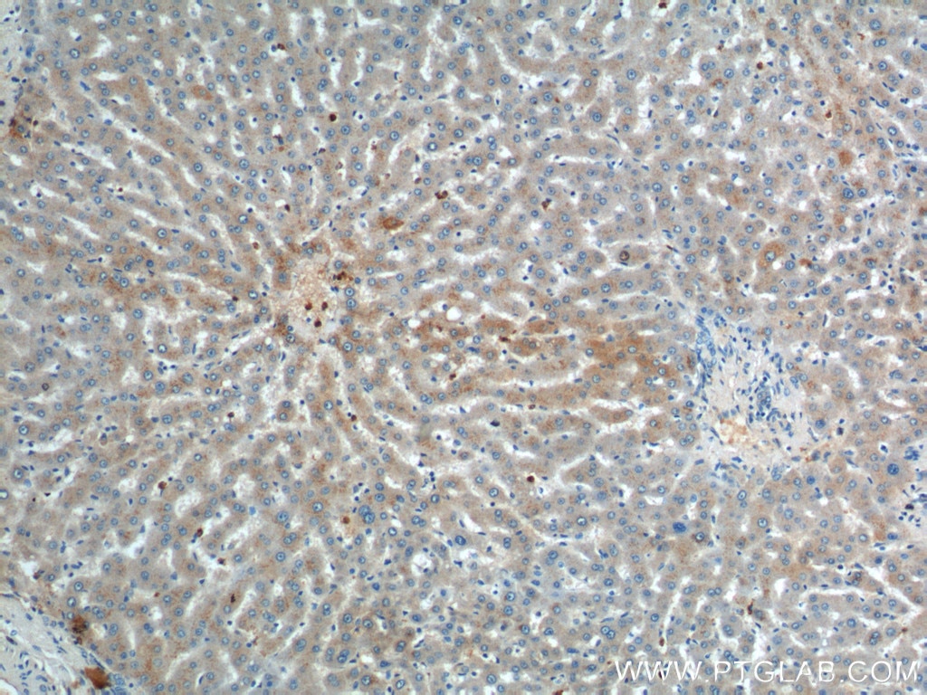 IHC staining of human liver using 20986-1-AP