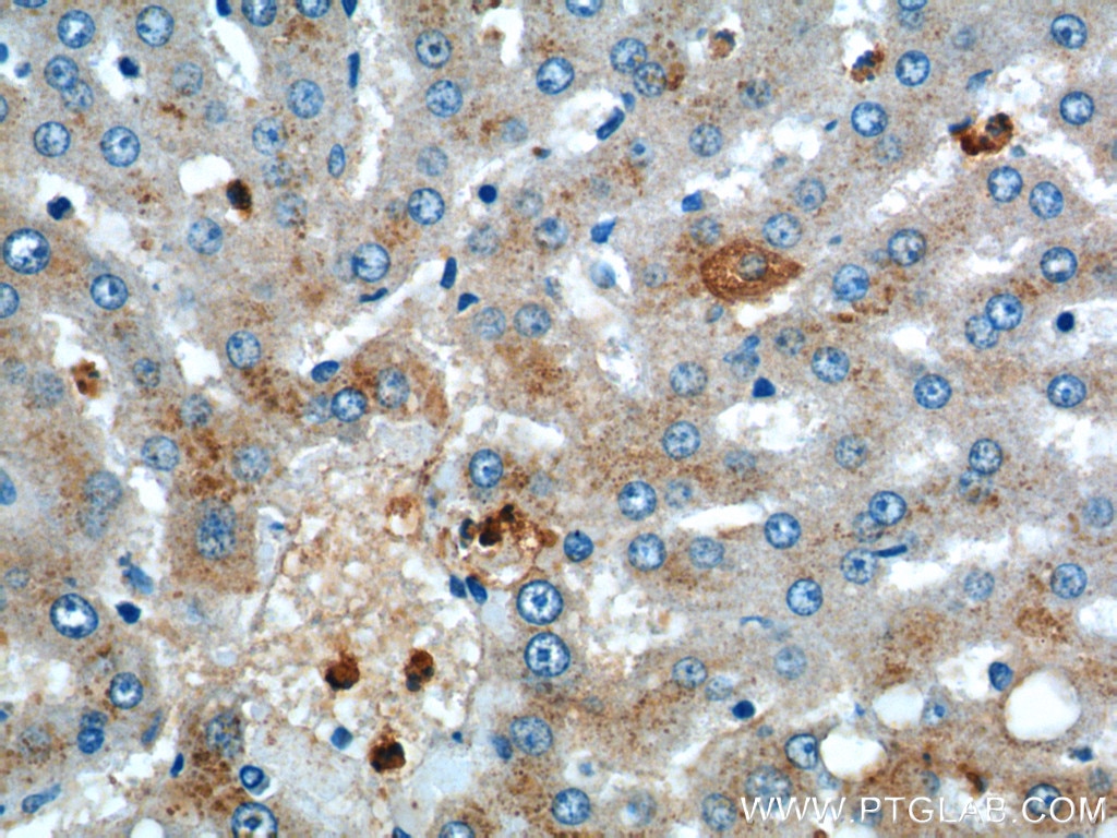 Immunohistochemistry (IHC) staining of human liver tissue using ULK1 Polyclonal antibody (20986-1-AP)