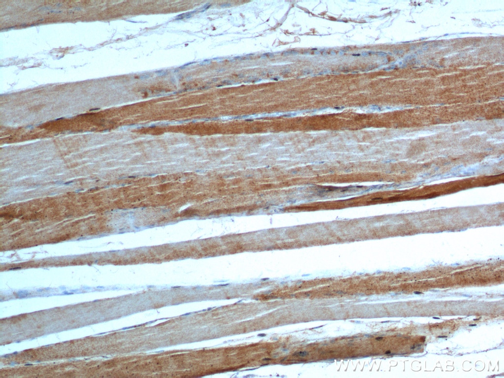 Immunohistochemistry (IHC) staining of human skeletal muscle tissue using ULK1 Polyclonal antibody (20986-1-AP)