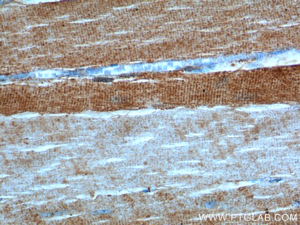 Immunohistochemistry (IHC) staining of human skeletal muscle tissue using ULK1 Polyclonal antibody (20986-1-AP)