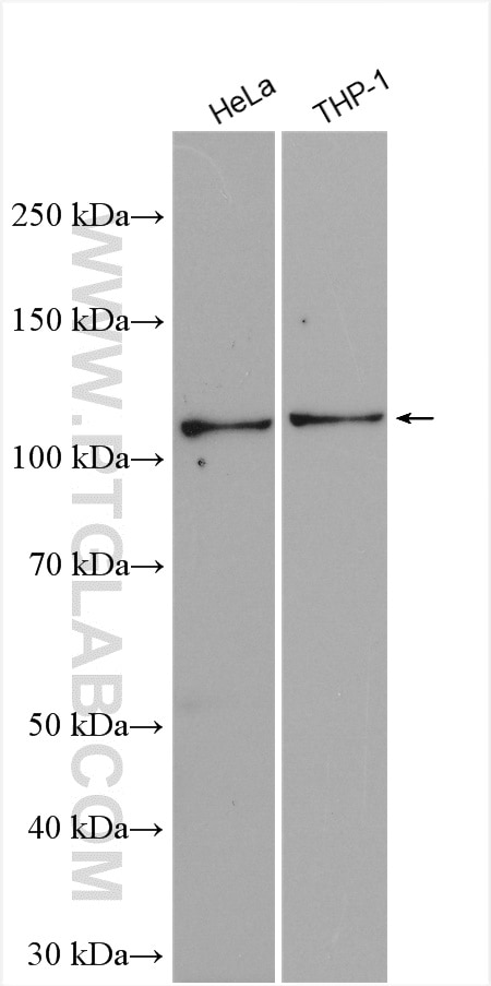 Western Blot (WB) analysis of various lysates using ULK1 Polyclonal antibody (20986-1-AP)