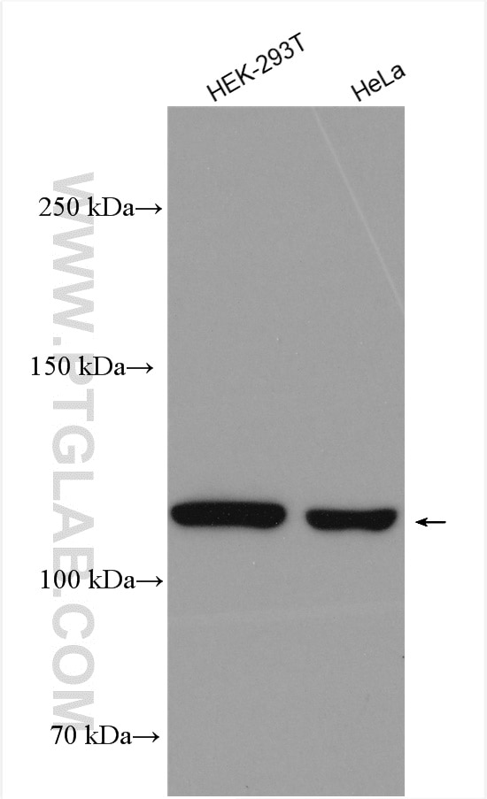 Western Blot (WB) analysis of HEK-293T cells using ULK1 Polyclonal antibody (20986-1-AP)