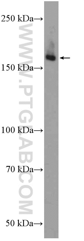 ULK1 Polyclonal antibody