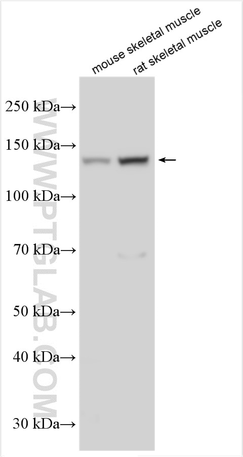 Western Blot (WB) analysis of various lysates using ULK1 Polyclonal antibody (20986-1-AP)
