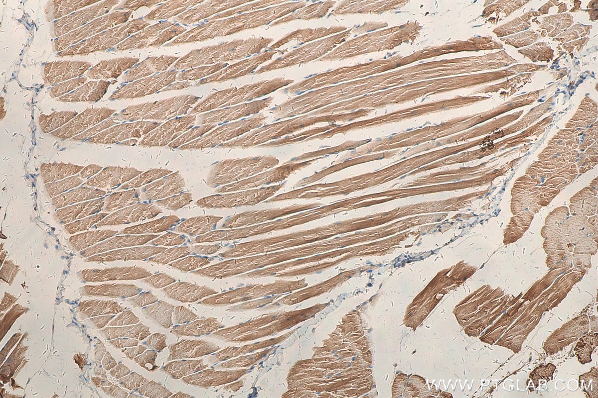 Immunohistochemistry (IHC) staining of mouse skeletal muscle tissue using ULK1 Polyclonal antibody (27352-1-AP)