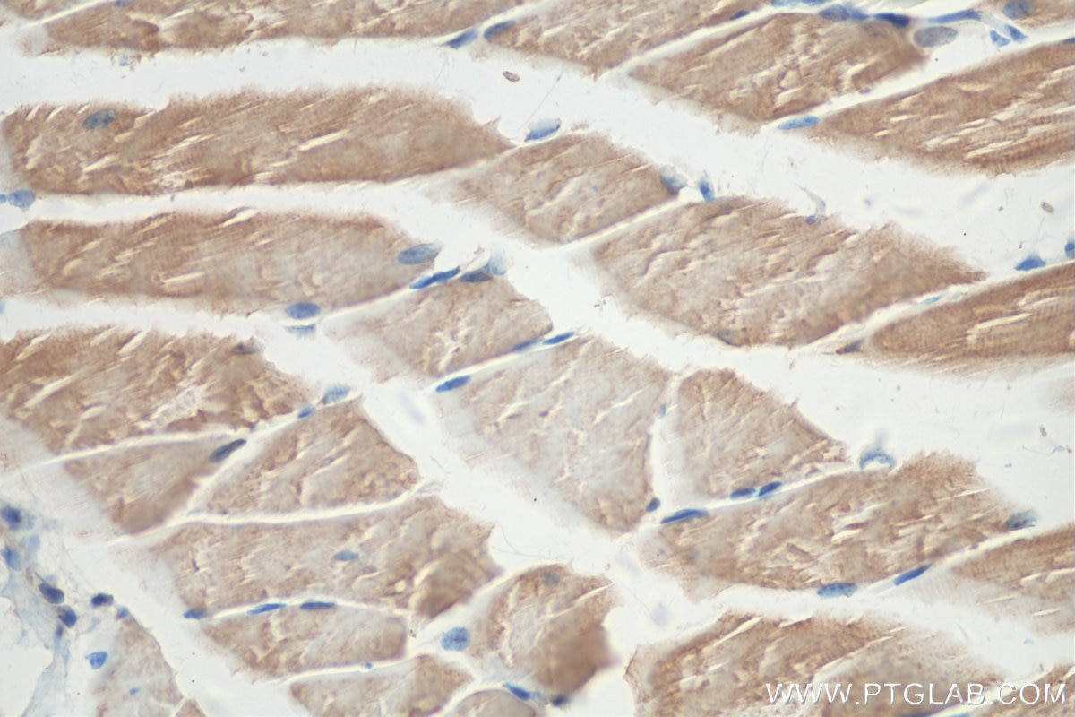 Immunohistochemistry (IHC) staining of mouse skeletal muscle tissue using ULK1 Polyclonal antibody (27352-1-AP)