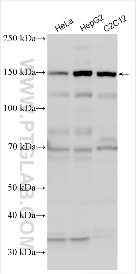 Western Blot (WB) analysis of various lysates using ULK1 Polyclonal antibody (27352-1-AP)