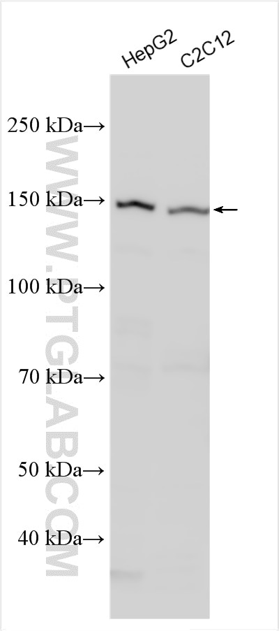 Western Blot (WB) analysis of various lysates using ULK1 Polyclonal antibody (27352-1-AP)